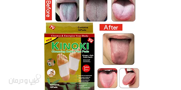 پد دفع سموم بدن کینوکی طلایی Kinoki Gold 2 پد دتاکس کینوکی طلایی اصل
