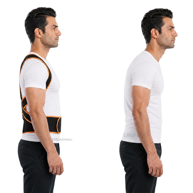 قوزبند طبی پلدار مدل YC7279 مقایسه